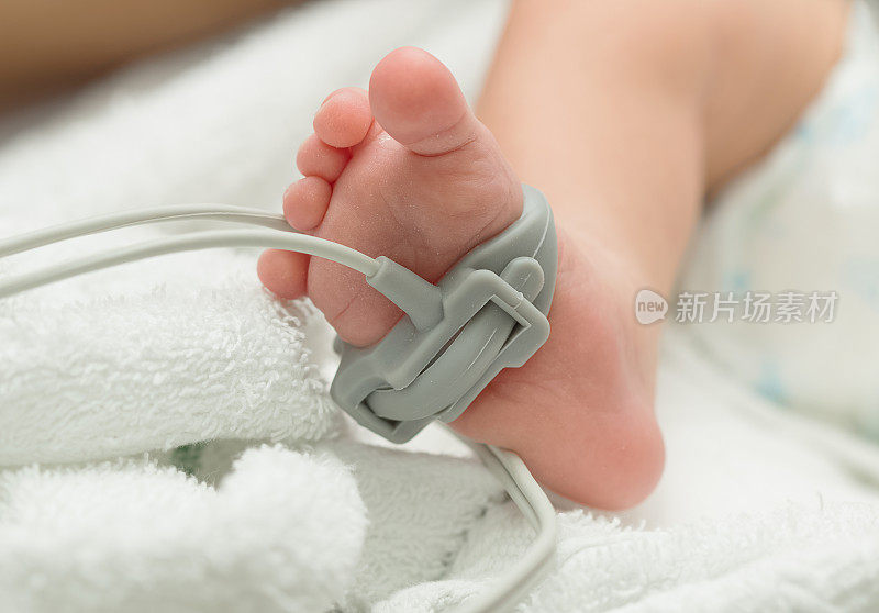 婴儿脚上的脉搏血氧计传感器