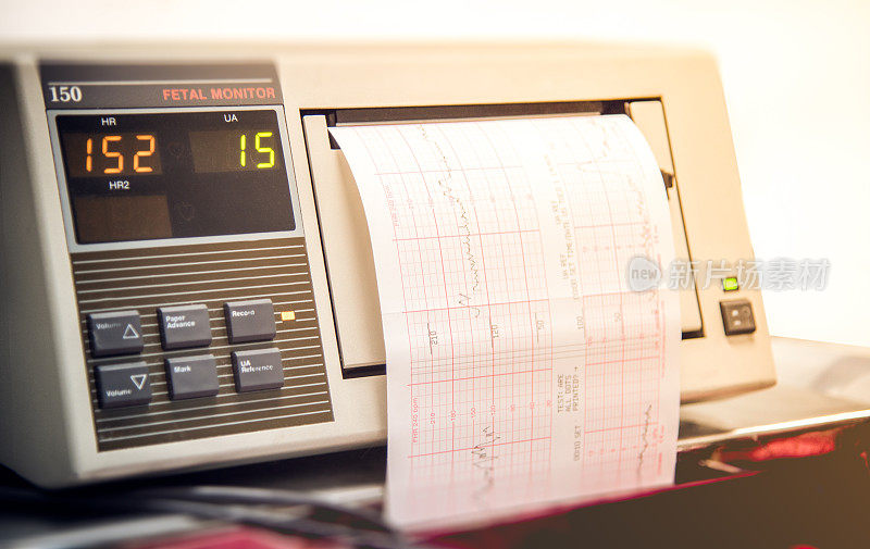 关闭显示器打印输出在产房跟踪婴儿的心跳和宫缩