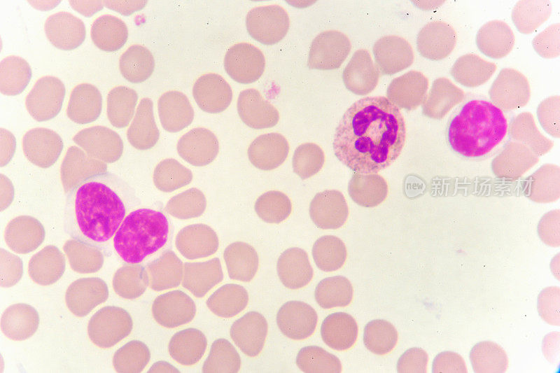 血液涂片中的白细胞