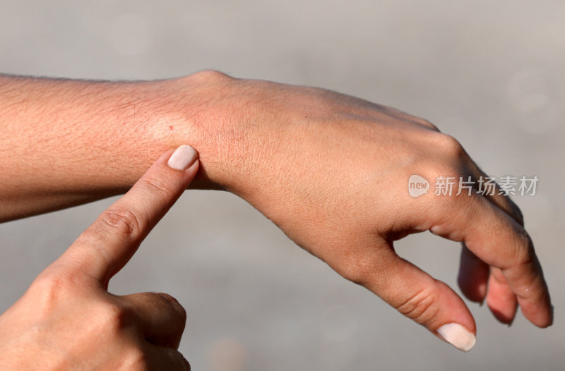 手指指着一个人的手腕，他们被蜜蜂蛰了