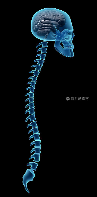 人类颅骨和脊椎的x光片，没有四肢