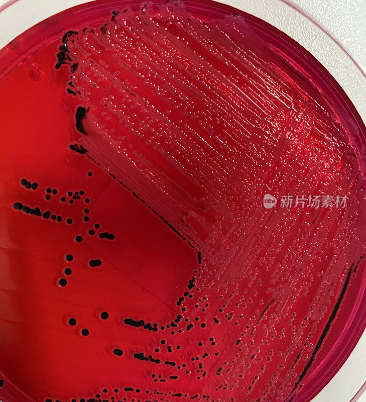 沙门氏菌在选择性琼脂板上生长。