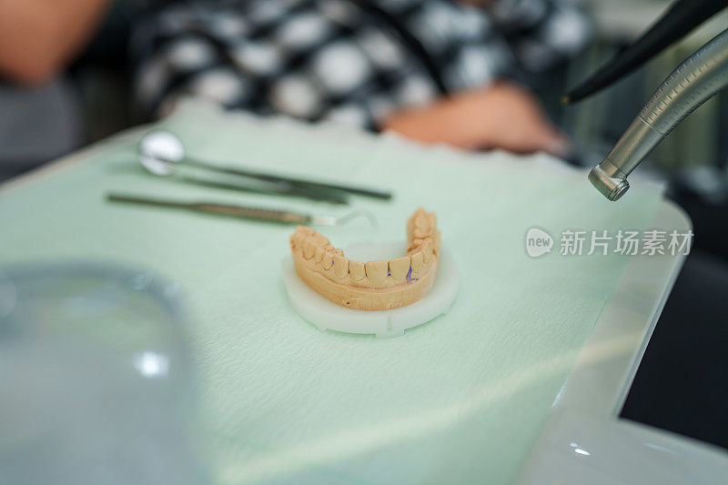 在正畸诊所用石膏在托盘上制作人颌模型。