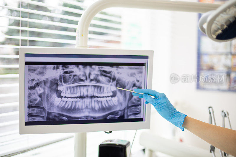 屏幕上的牙科x光照片