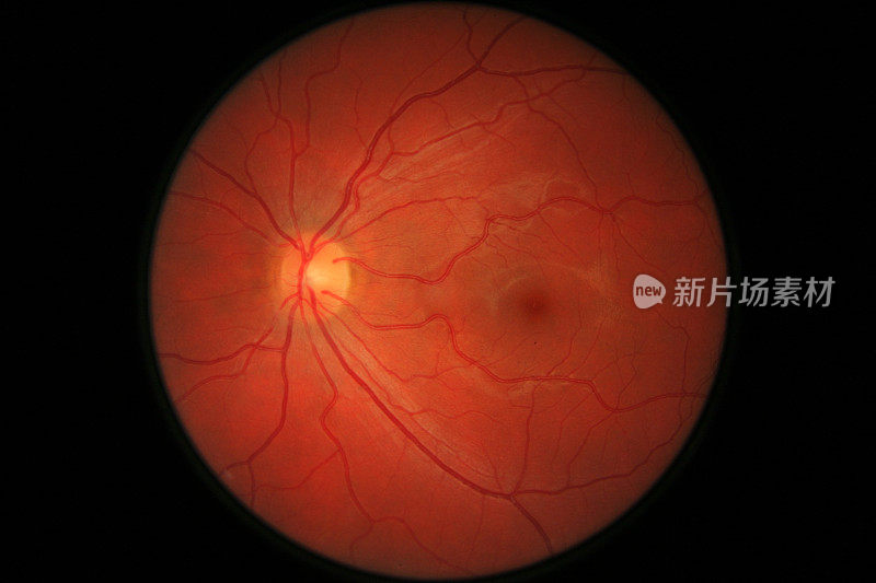 眼睛视网膜扫描