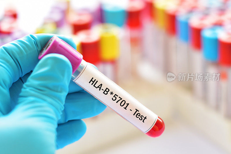 HLA-B*5701检测血样