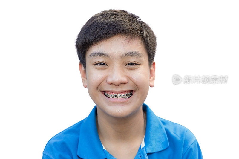 年轻人微笑着用牙齿支撑牙齿在孤立的背景上。