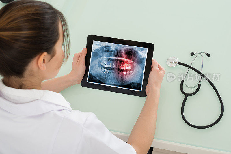 女医生在数字平板上看牙科x光片