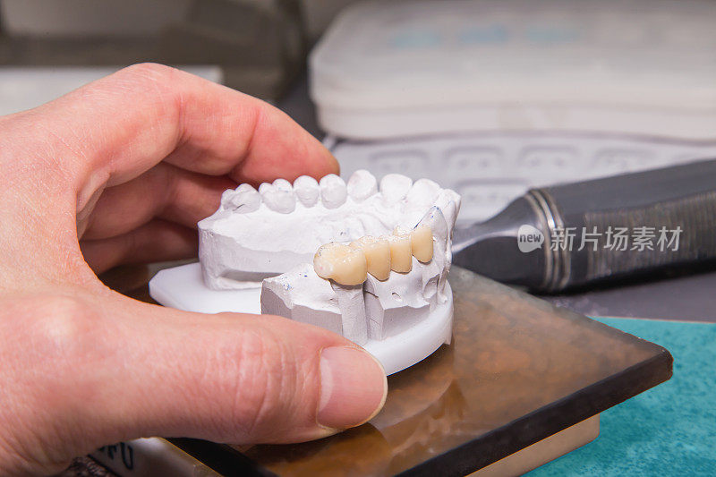 牙科修复实验室模型的技术镜头