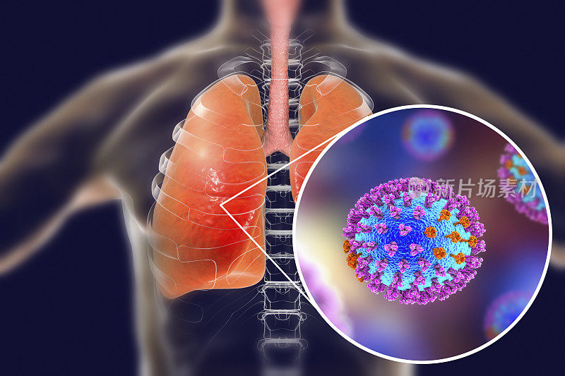 流感病毒存在于人类肺部