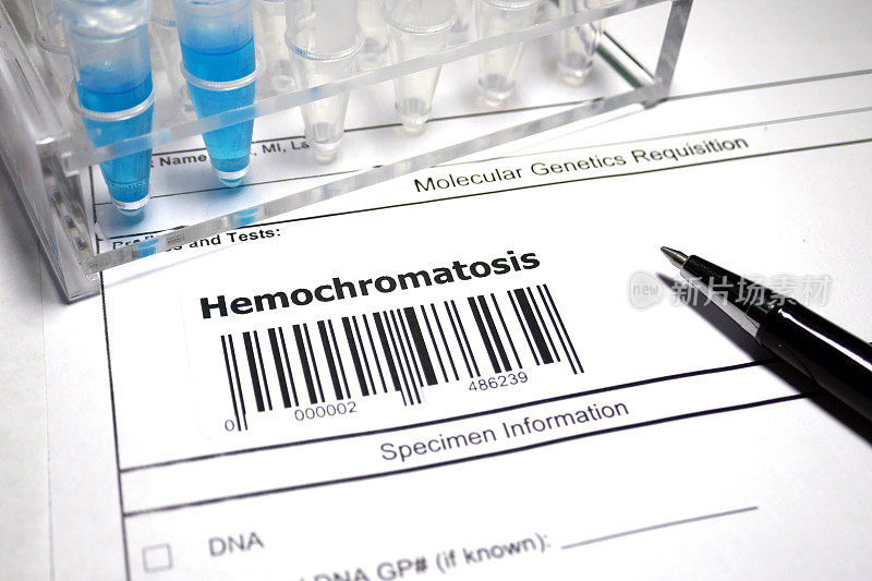 遗传haemochromatosis