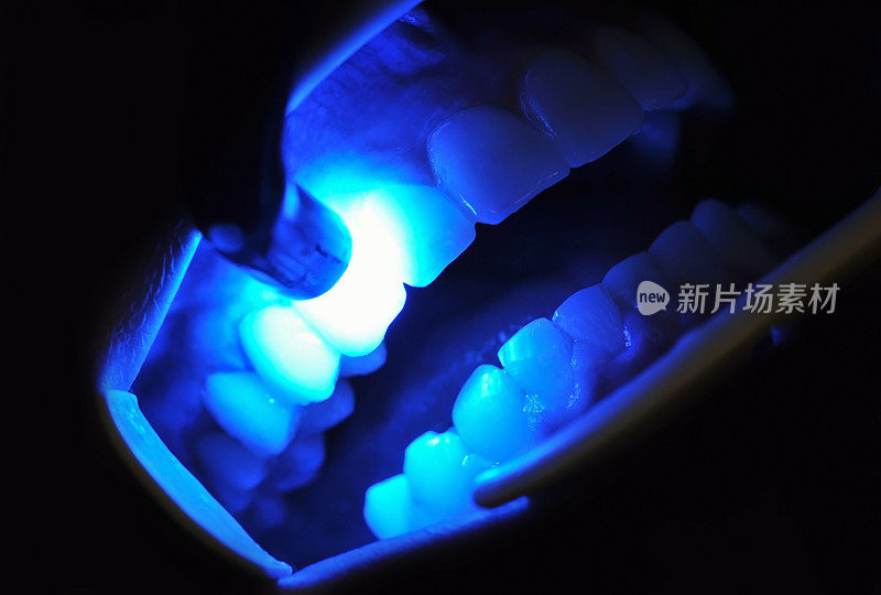 牙科治疗