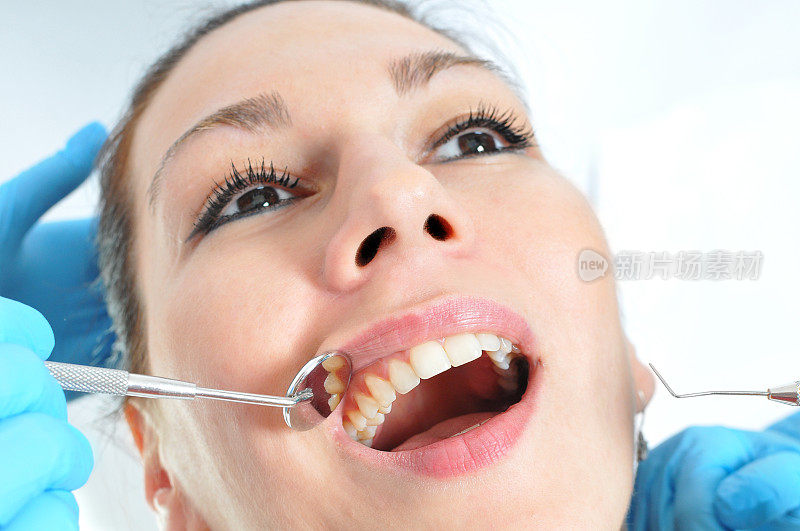 口腔检查-牙科医生检查病人的口腔和牙齿