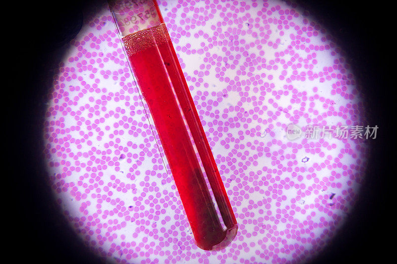 显微镜下的人类血液涂片