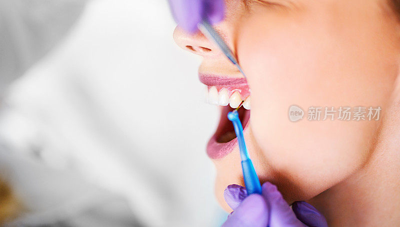 牙科医生使用专利探针测量牙间隙。