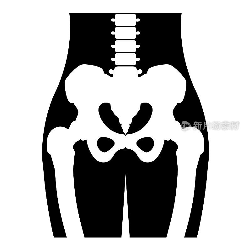 骨盆和股骨