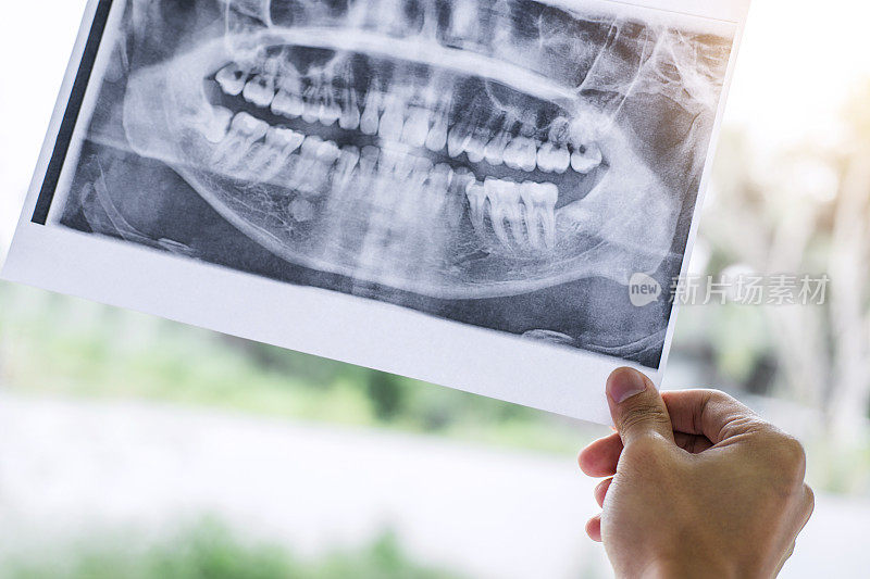 男医生或牙医拿着看牙科x光片