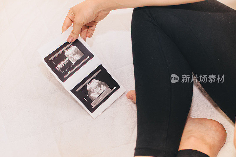 孕妇看她的宝宝的3D超声波照片