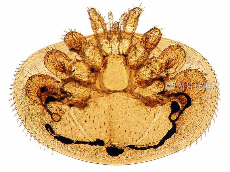 螨虫的显微图像