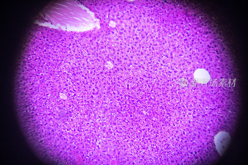 显微镜下肝横切面
