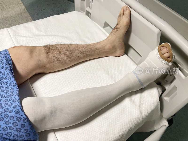 手术腿部，腿部手术患者躺在医院病房的床上