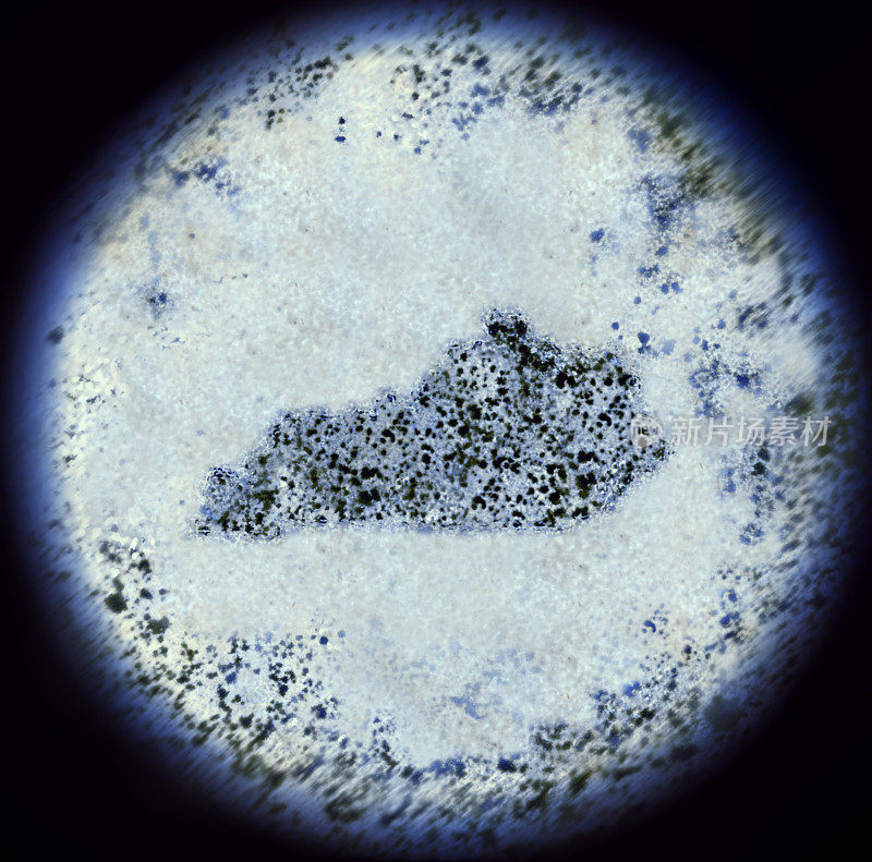 显微镜下的肯塔基形细菌。(系列)
