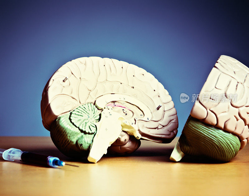 脑损伤还是重要的医疗保健?皮下解剖模型