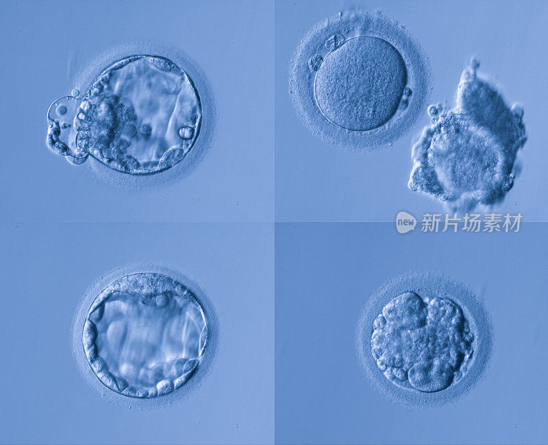 人类卵细胞
