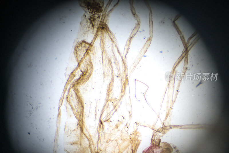 Mosquito-Male在显微镜下