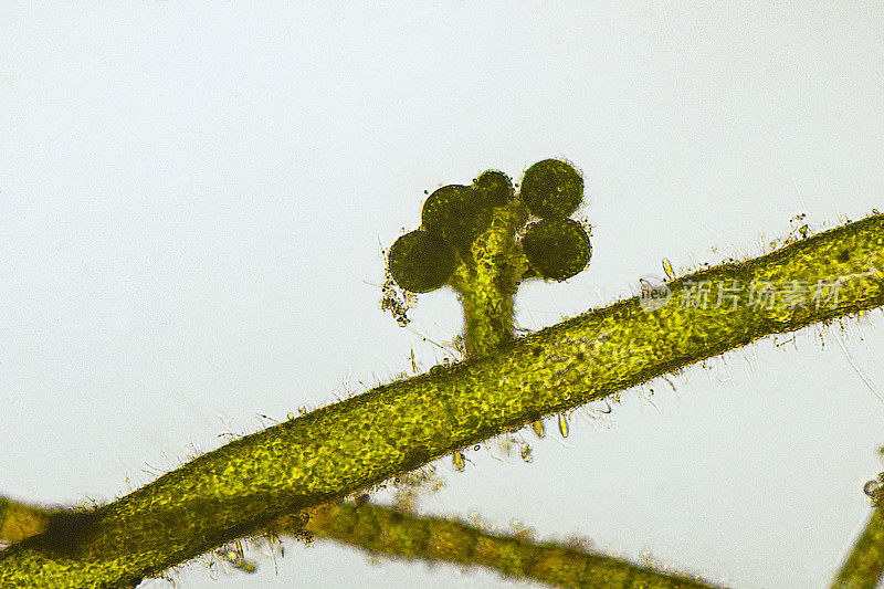黄绿藻中弯菌属的显微照片