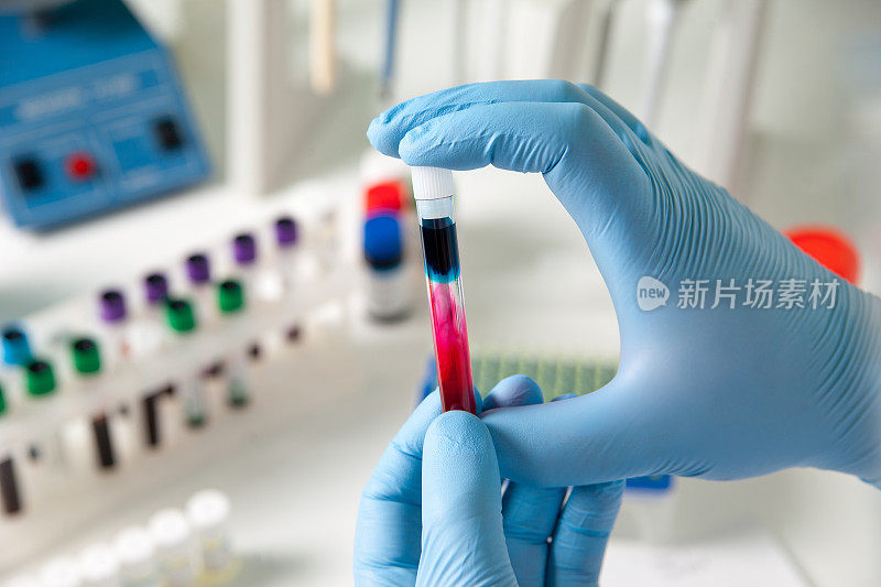 台式实验室医疗设备，用于血液检测和全血细胞计数结果
