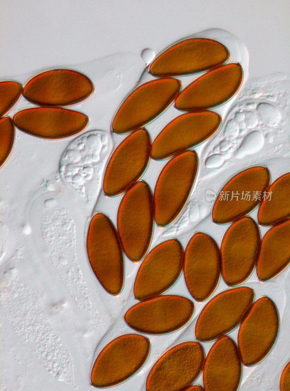 子囊菌真菌citrigena的腹膜和子囊孢子