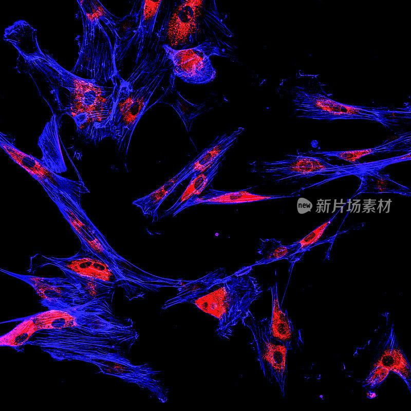 黑色素瘤癌细胞的免疫荧光共聚焦成像