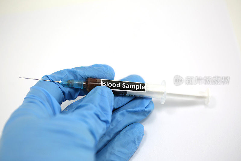 注射器中装满了待医学实验室分析的血液和文本血液样本
