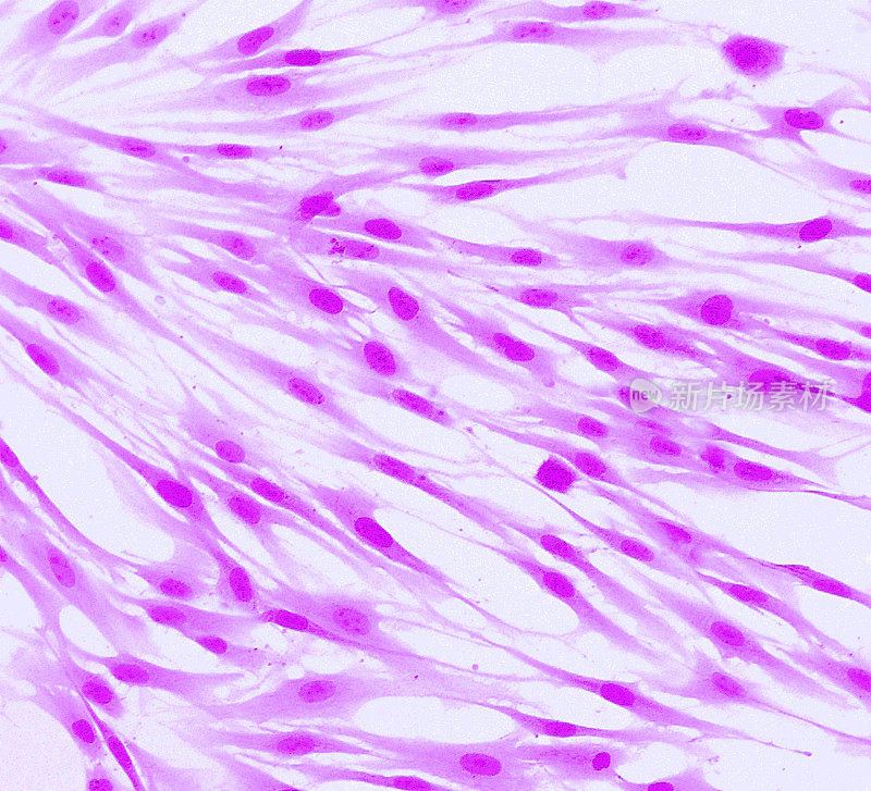 成纤维细胞(皮肤细胞)用荧光染料标记