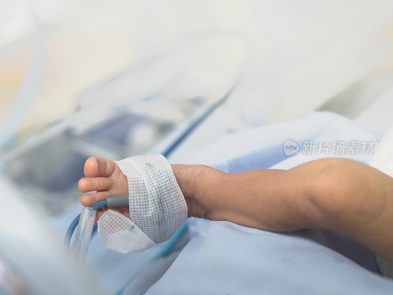 用于治疗早产儿的带医疗监护设备的保温箱中的新生儿腿