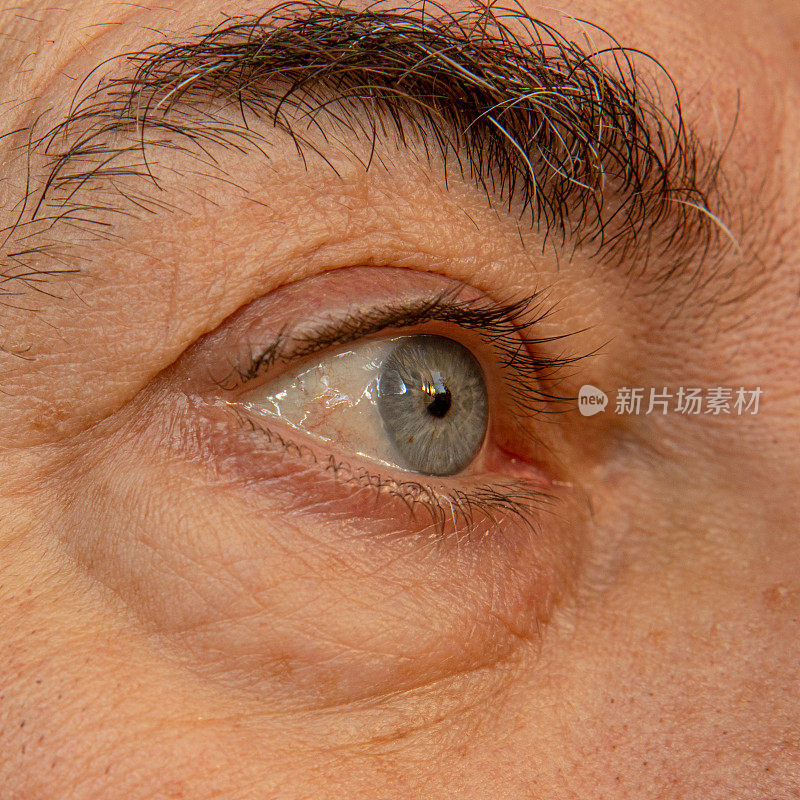 一个满脸皱纹的老男人的疲倦的红眼。