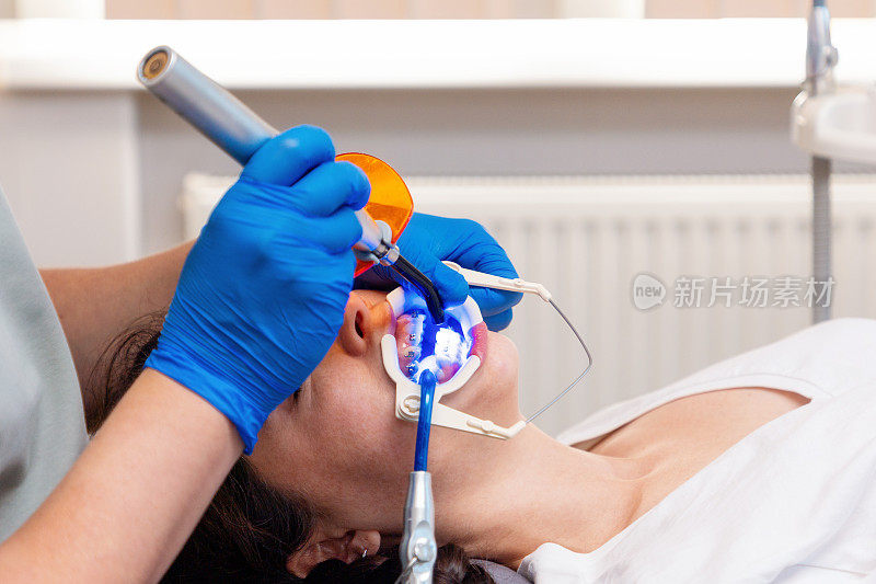 正畸医师在病人牙齿上固定绑扎牙套的侧视图。副本的空间。正畸学和口腔医学的概念