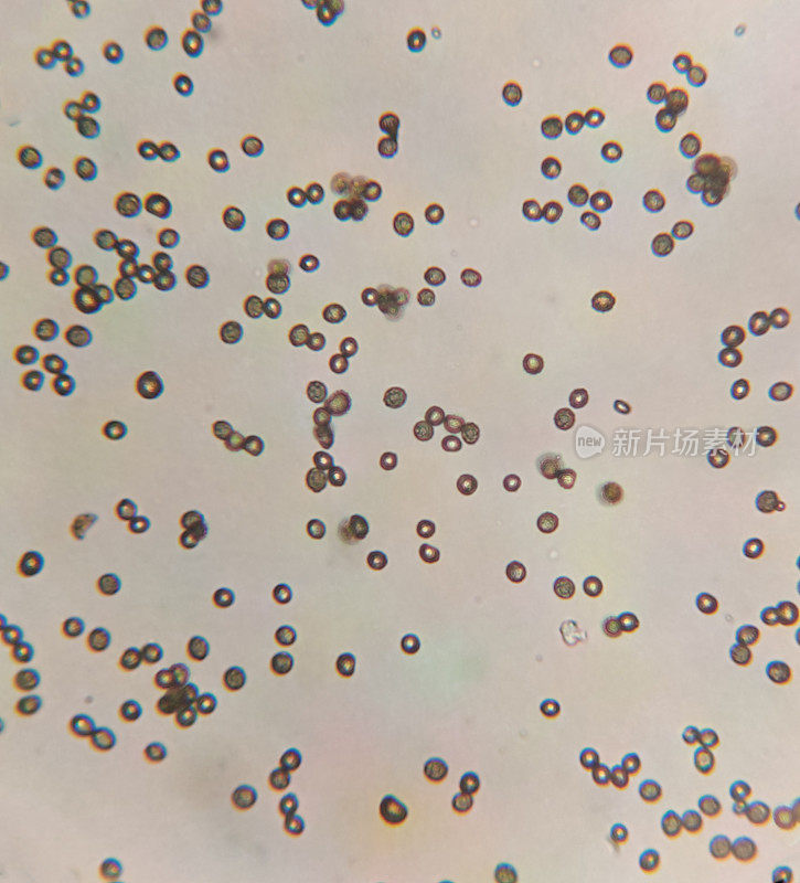 显微镜下青霉菌孢子
