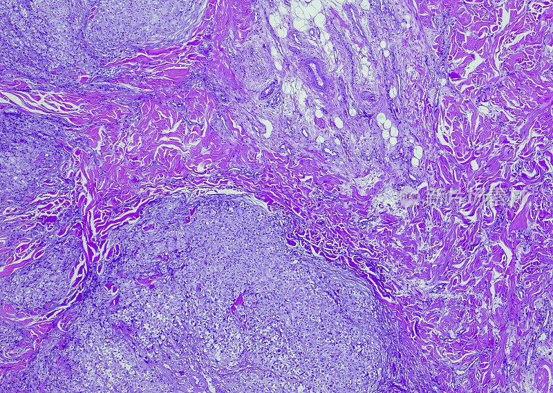 对乙酰氨基酚hepatoxicity