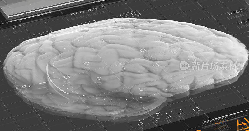 这是一个基于计算机的未来数字软件HUD界面，其系统可以远距离传输大脑活动的图像，这将使它可以用于神经外科手术。
