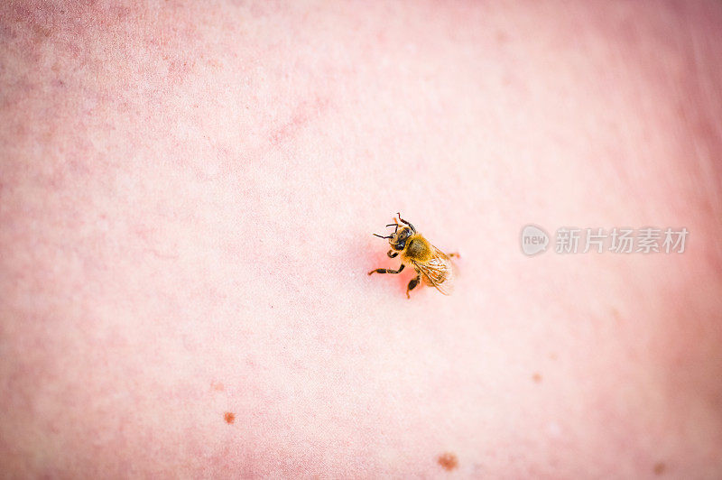 一只蜜蜂在人的皮肤上，人类昆虫相互作用