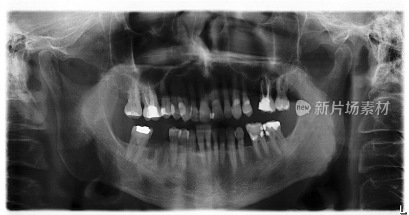 牙科x光2