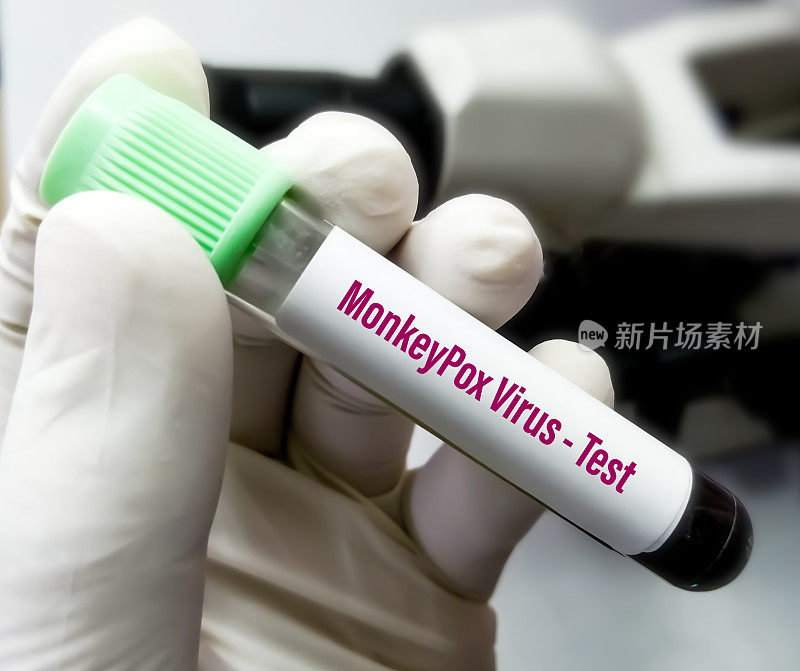 猴痘病毒是一种双链DNA病毒，属于痘病毒科。