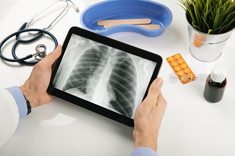 医生分析病人肺部x线结果的数字平板电脑