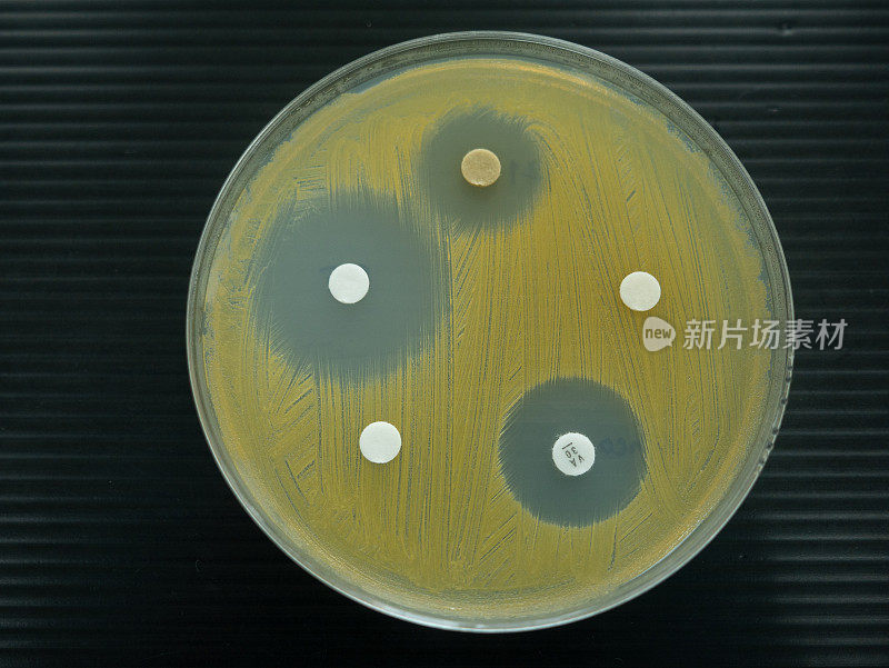 在实验室检查抗生素的培养皿的特写镜头。