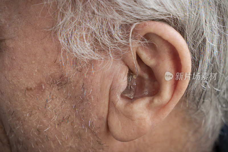 戴在老人耳朵里的助听器
