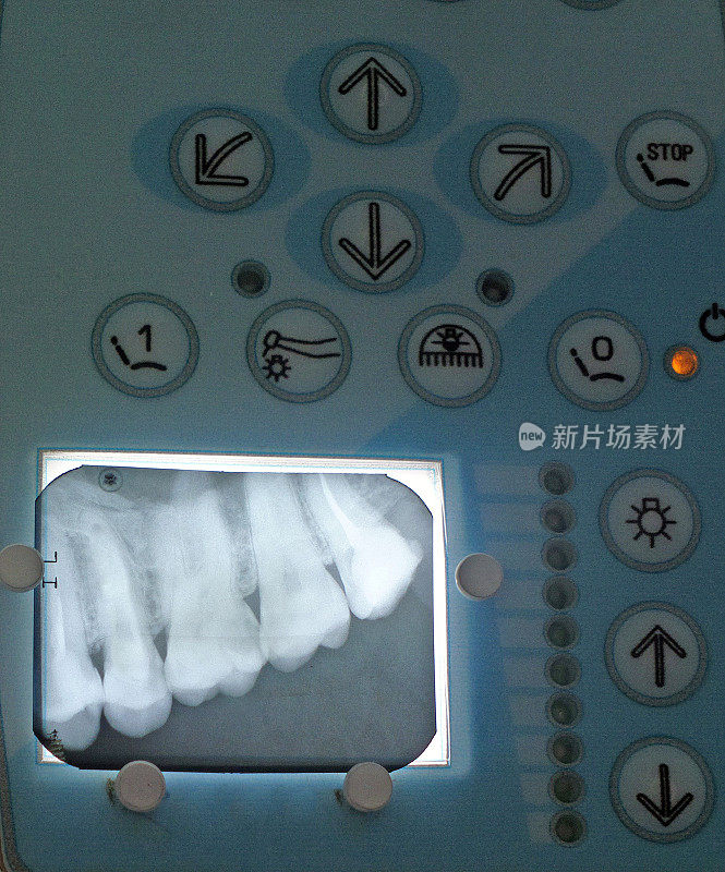 牙齿x光诊断仪。