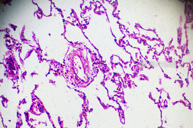慢性支气管炎不同部位显微镜放大
