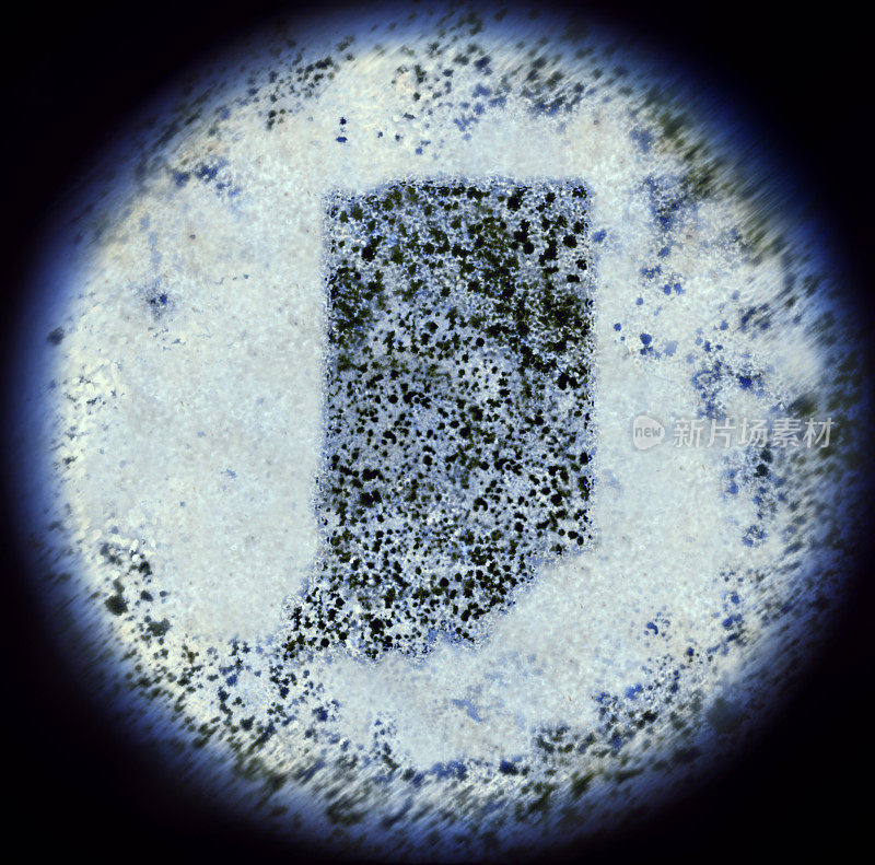 显微镜下的印第安纳型细菌(系列)